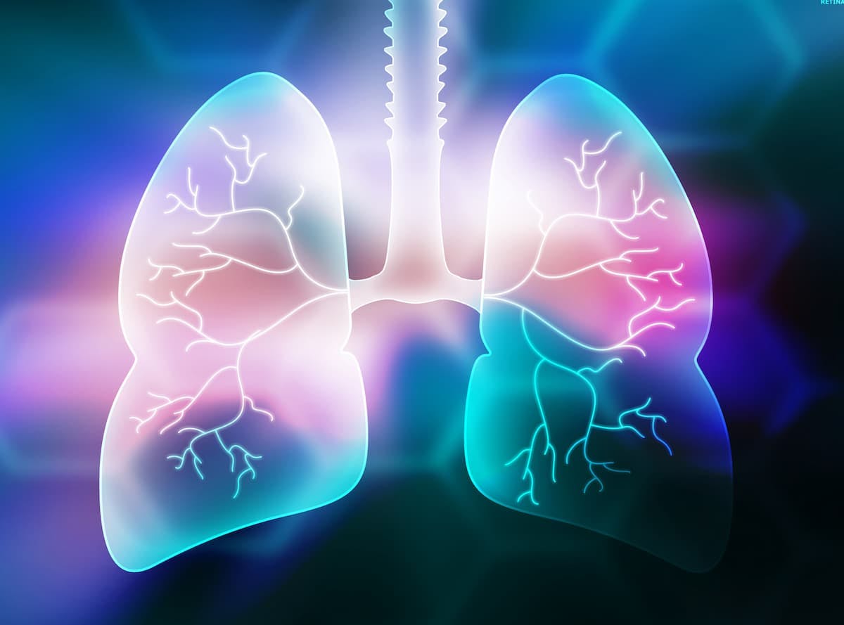 In April 2024, the FDA approved alectinib for the adjuvant treatment of patients with ALK-positive non–small cell lung cancer with tumors that are at least 4 cm or node-positive as detected by an FDA-approved test.