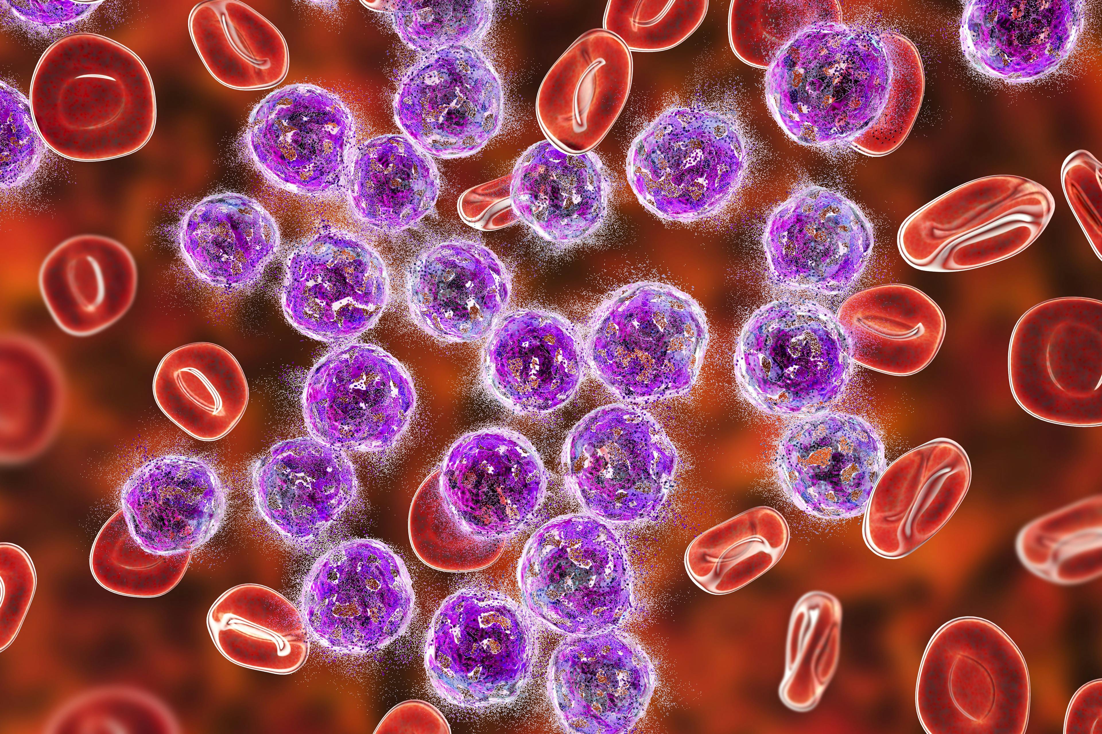 Investigators announced positive topline results for the phase 3 QuANTUM-First trial, assessing the use of quizartinib plus chemotherapy for adult patients with newly diagnosed FLT3-ITD–positive acute myeloid leukemia.