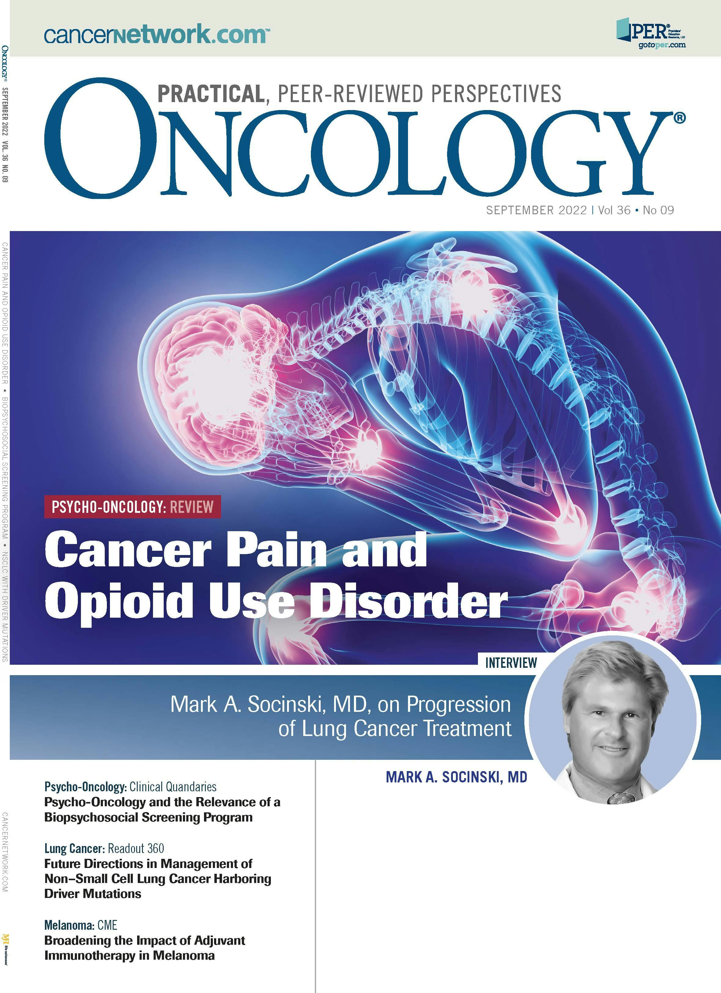 ONCOLOGY Vol 36, Issue 9