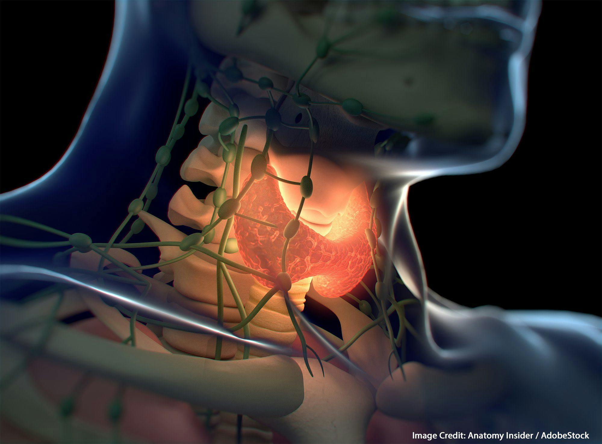 Genomic Analysis of Anaplastic Thyroid Cancer 