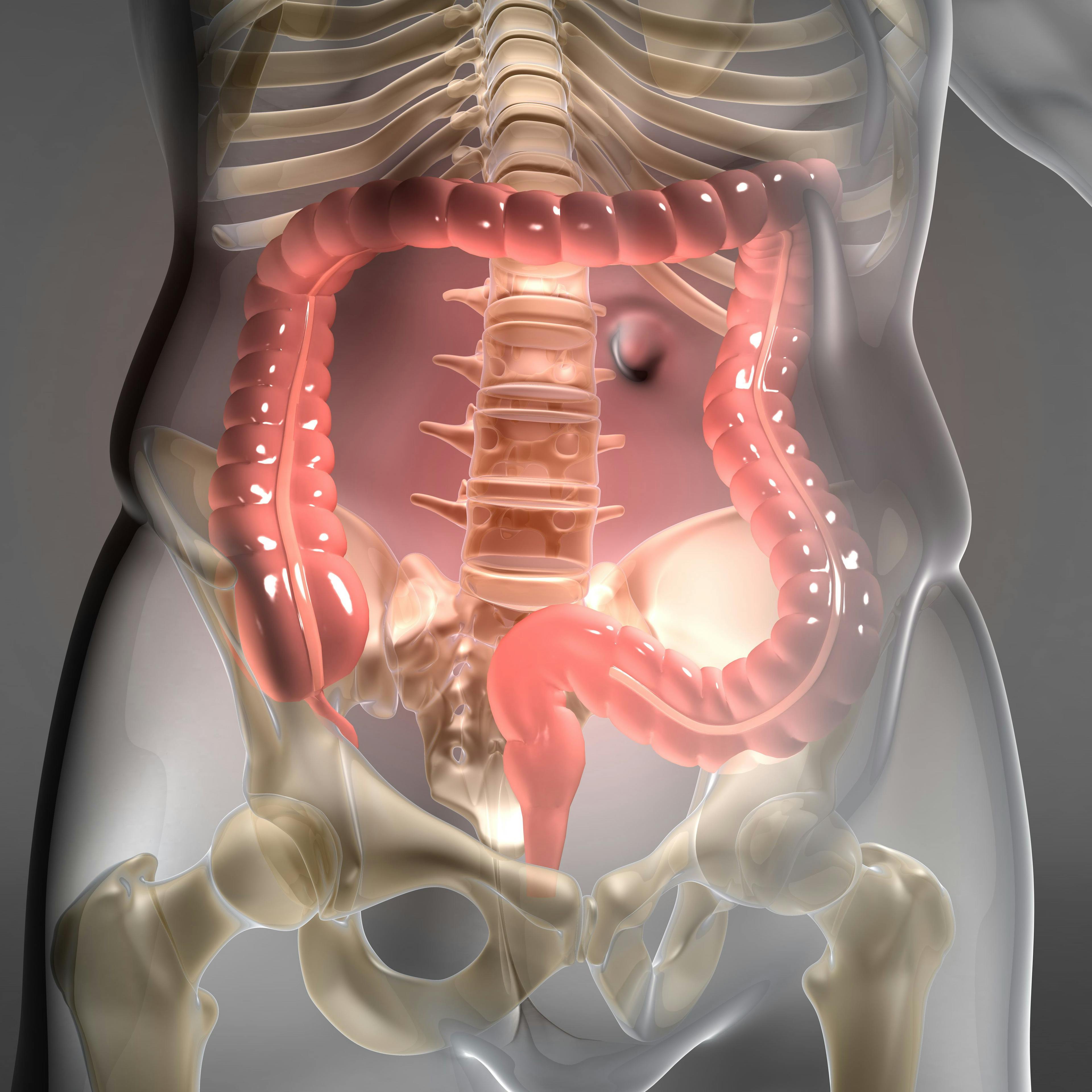 "These data support adagrasib and cetuximab as a new potential standard of care [SOC] for patients with previously treated metastatic KRAS G12C[–mutant] colorectal cancer and will hopefully support a new SOC in the regulatory environment," according to Scott Kopetz, MD, PhD.