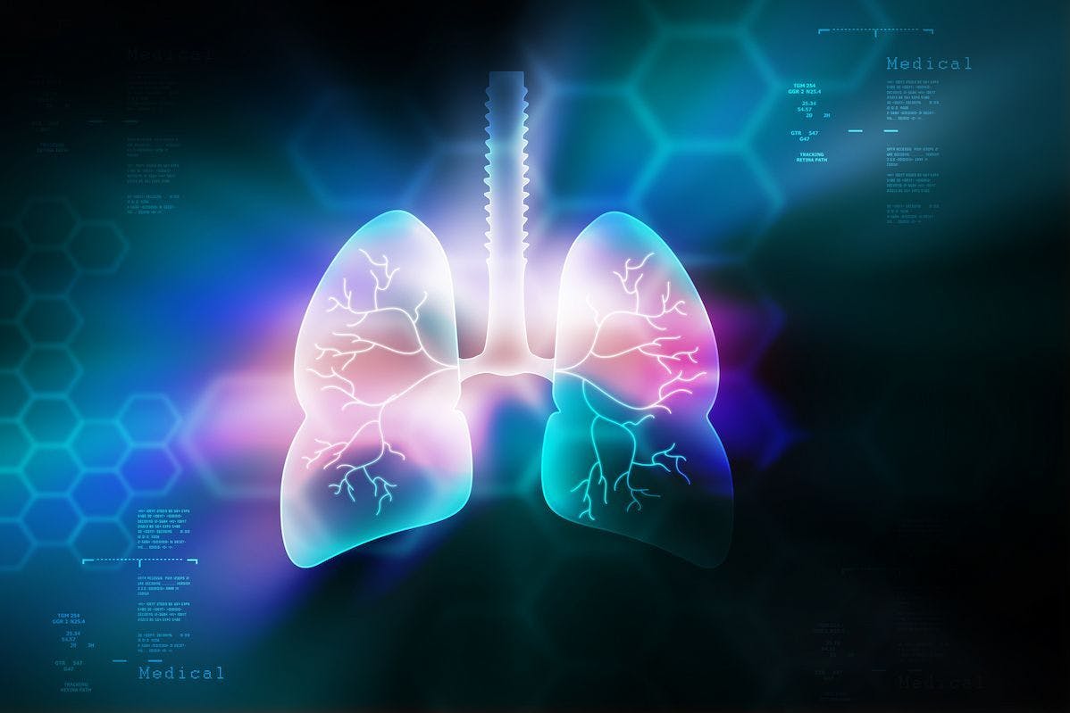 Results from the phase 2 PERLA trial showed an improved objective response and overall survival in treatment with dostarlimab plus chemotherapy in patients with treatment-naïve, nonsquamous non–small cell lung cancer.