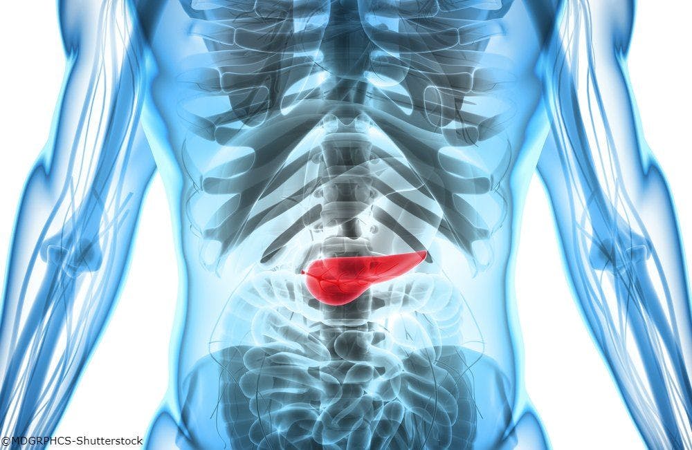 Improved Risk Models Identify People at Higher than Normal Risk of Pancreatic Cancer