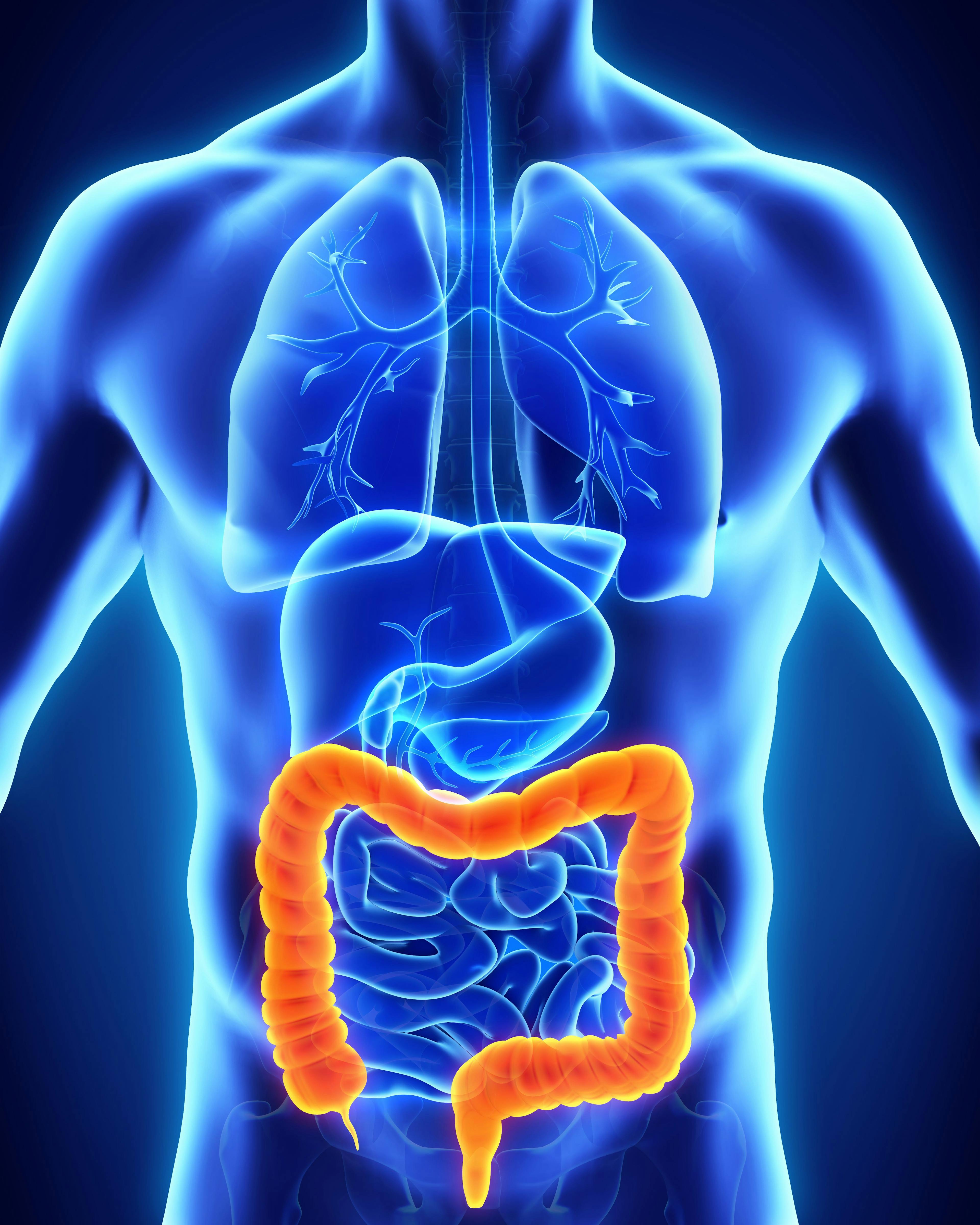 Development on CYAD-101 continues as a treatment for patients with refractory/metastatic colorectal cancer after the FDA has lifted a clinical hold on the phase 1b CYAD-101-002 trial.