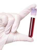 Blood sample