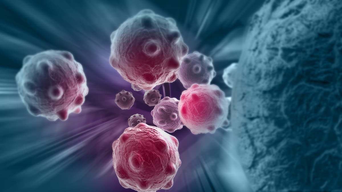 Older patients with hematological malignancies who received Orca-T therapy plus myeloablative chemotherapy have similar relapse-free survival rates compared with younger patients.