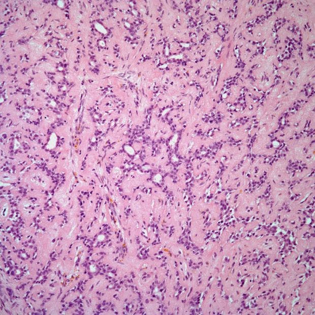 Patient Presents With Breast Nodule