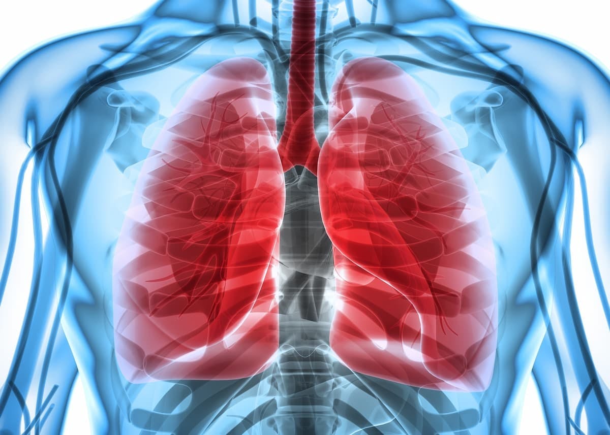Mobocertinib Improves PROs in Previously Treated EGFR Exon 20+ NSCLC