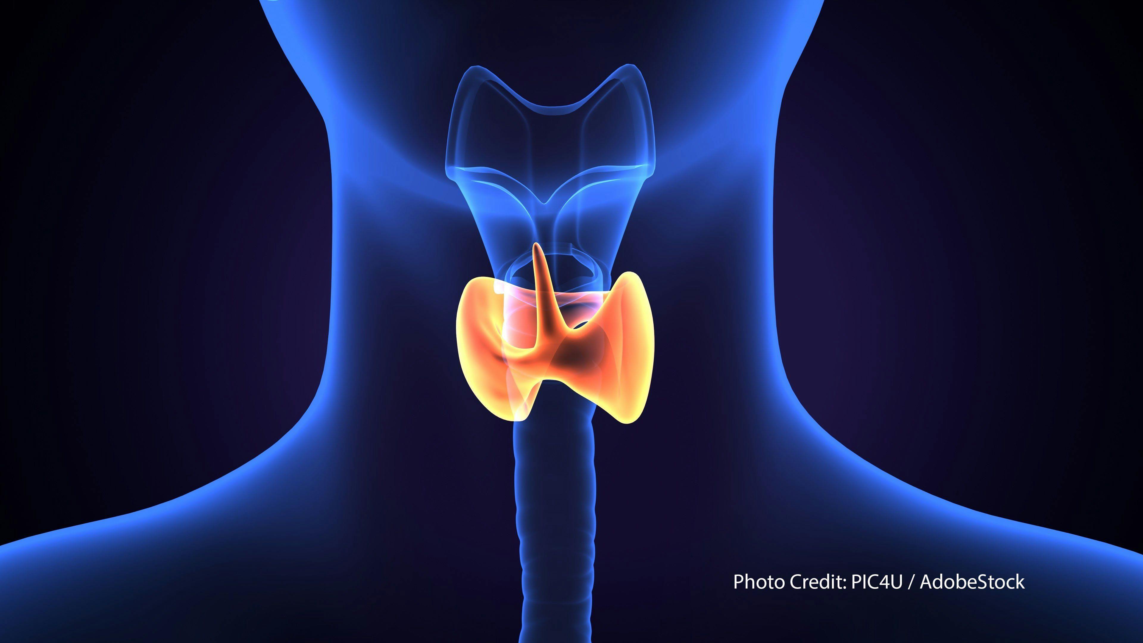 Improved diagnostics for thyroid cancer on horizon