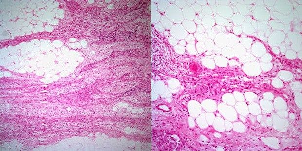 Neck Mass Discovered in 38-Year-Old Man