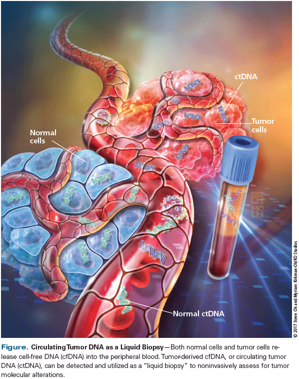 Circulating Tumor DNA as a Liquid Biopsy: Current Clinical Applications and Future Directions