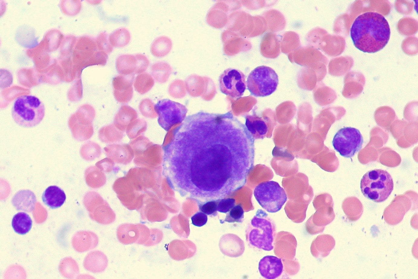 A new drug application for imetelstat in anemia-dependent, lower-risk MDS was accepted by the FDA in August 2023.
