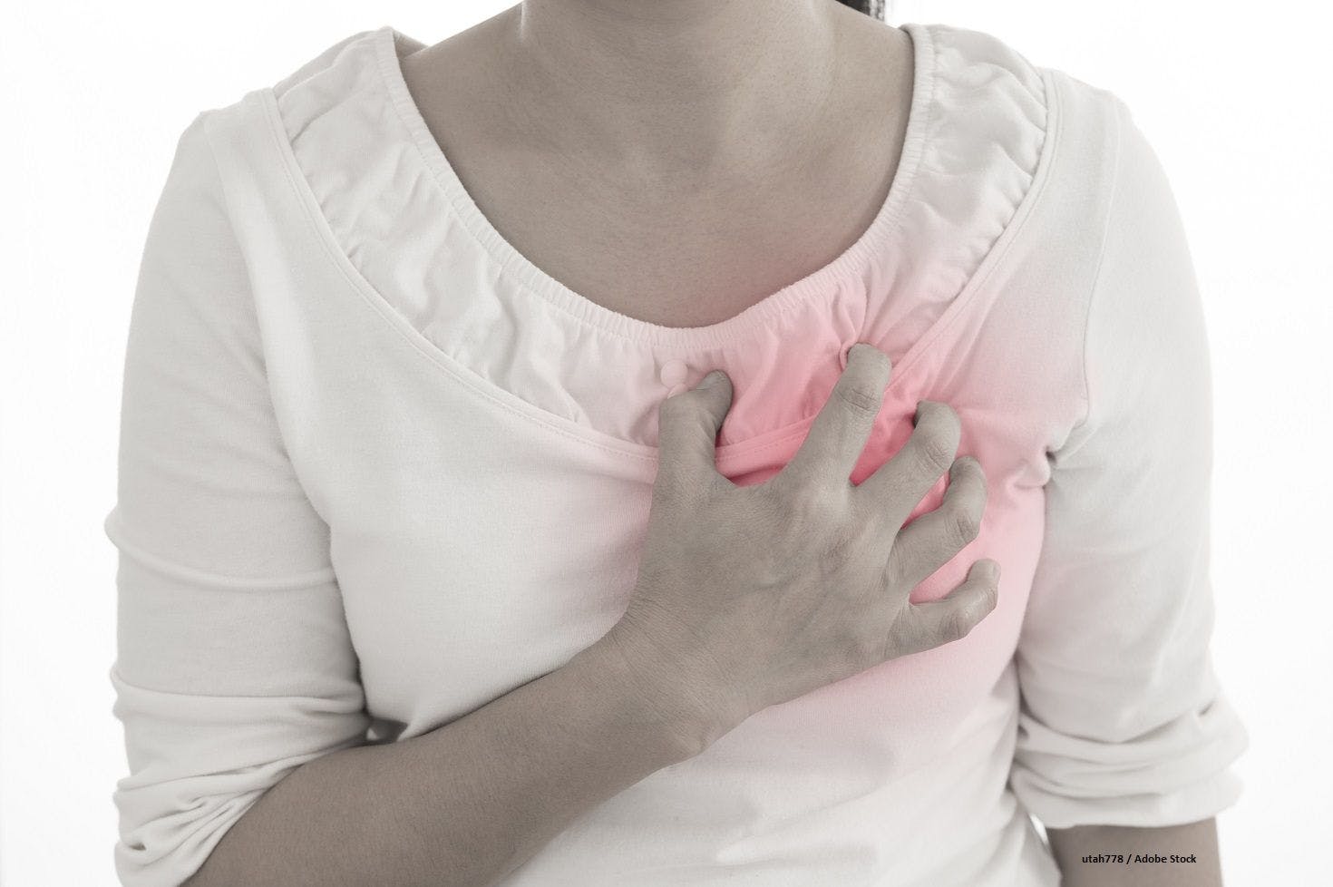 Alternative Chemo Formulations May Help Reduce Cardiac Toxicity in HER2+ Breast Cancer