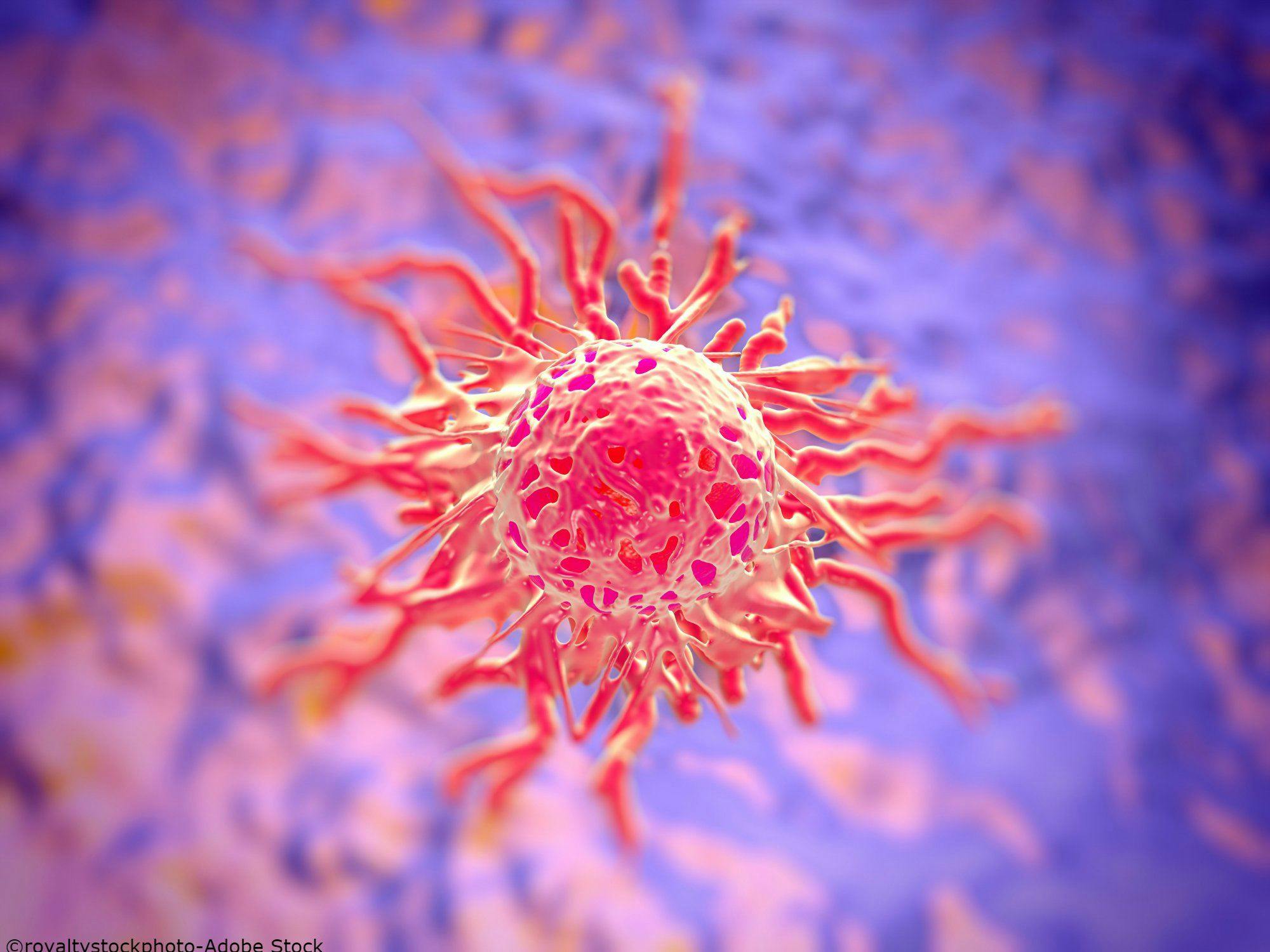 HPV Gene Expression Signatures, Prognosis in Cervical Cancers