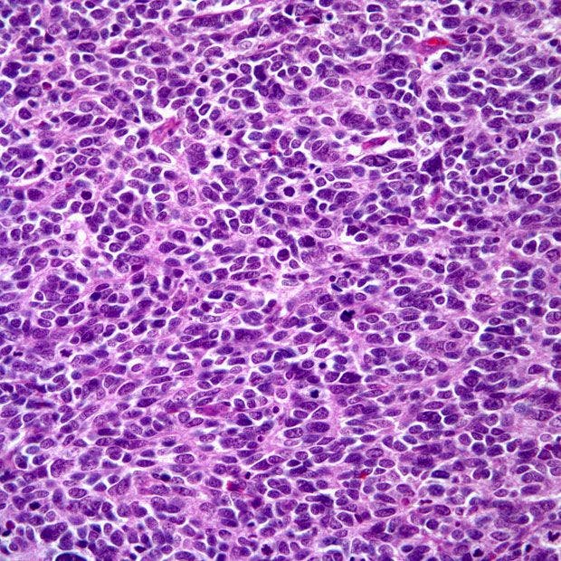 Patient Presents With Skin Lesion