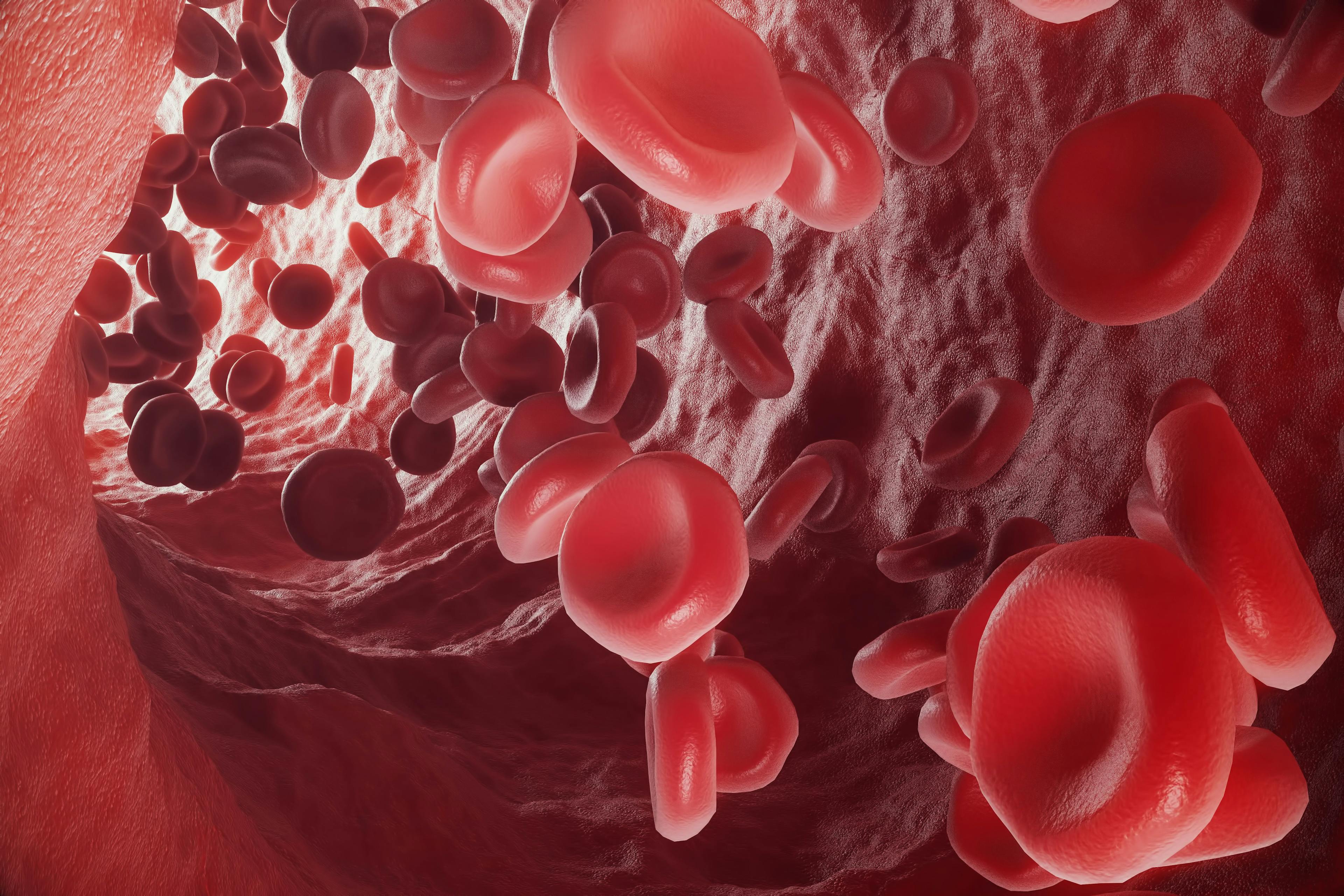 Patients with high-risk polycythemia vera had a worse survival probability at 4 years compared to patients with low-risk disease.