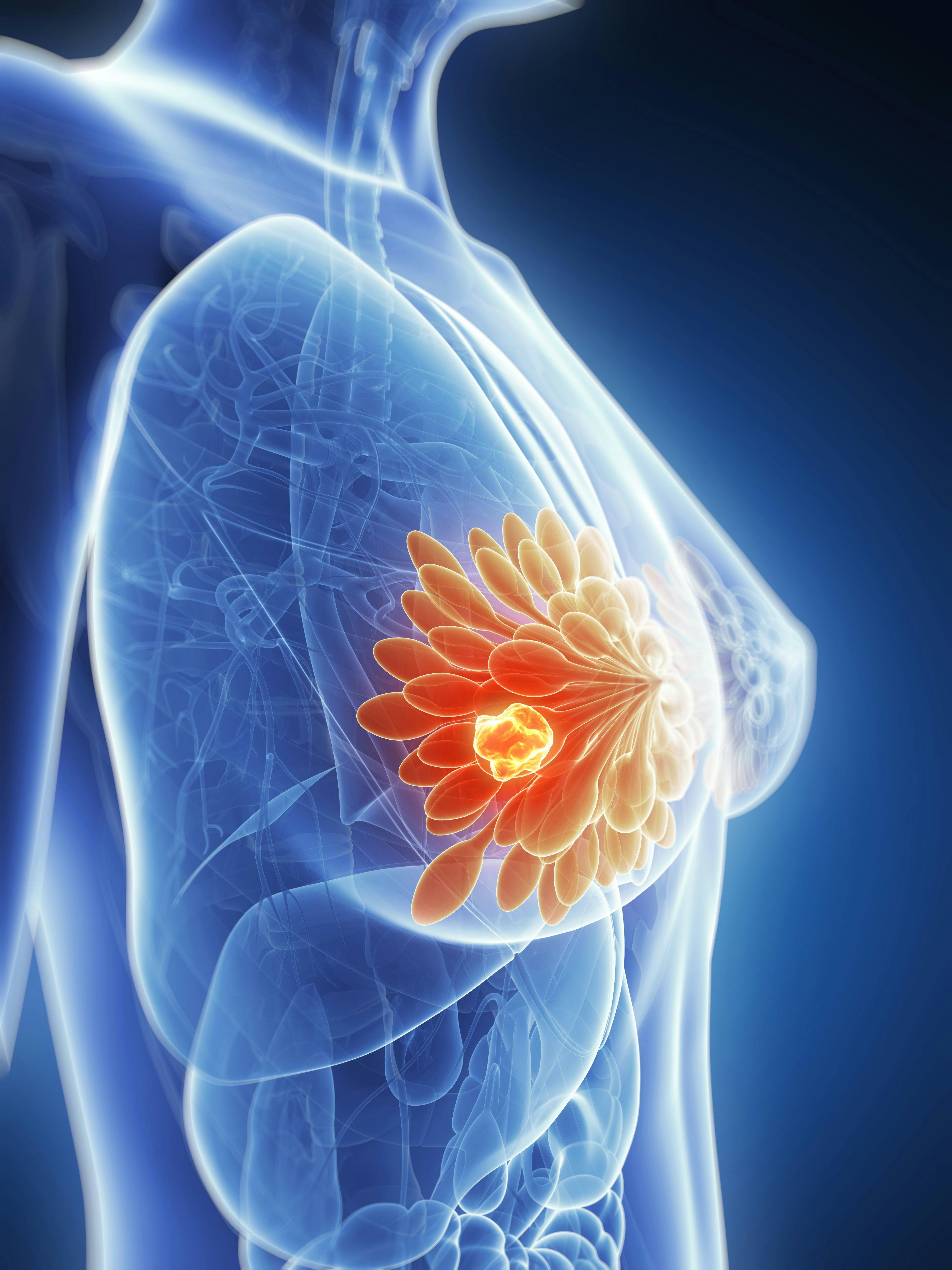 Adjuvant Palbociclib Plus Endocrine Therapy Did Not Show Benefit in Early HR+ HER2 Negative Breast Cancer