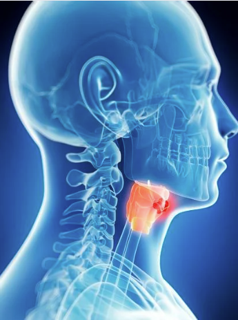 Increased Thyroid Cancer Risk Not Observed After Use of GLP1 Receptor Agonist