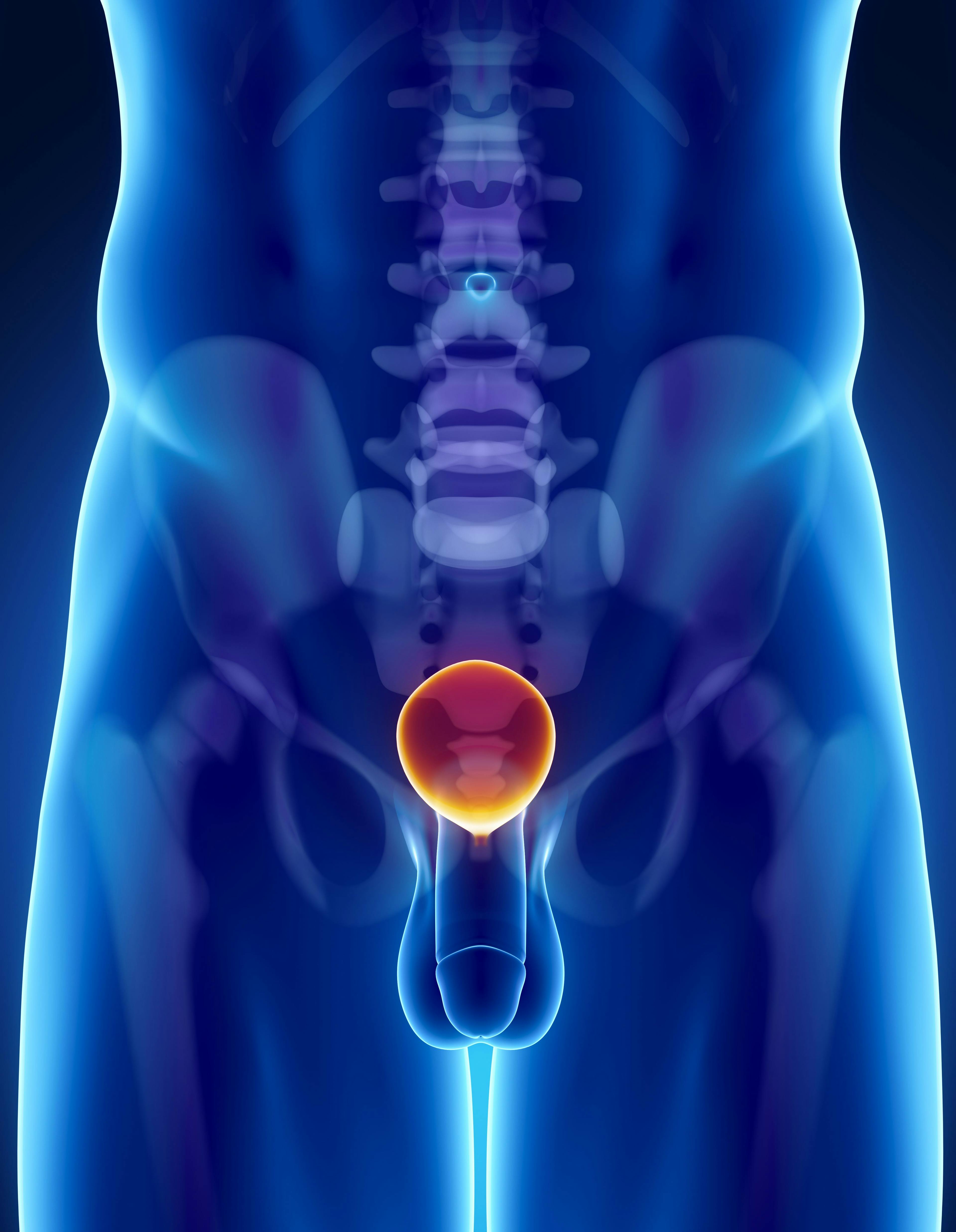 Younger African American Men With Prostate Cancer Show Improved Outcomes With More PSA Screenings