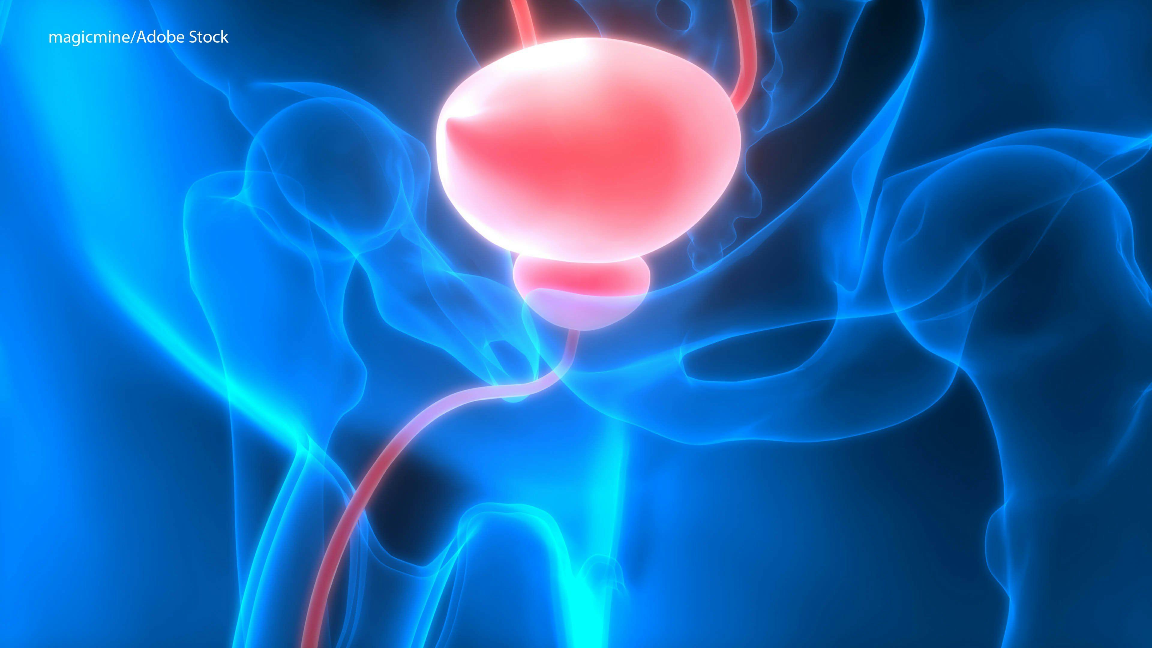 Apalutamide Survival Benefits Unclear for Castration-Resistant Prostate Cancer   