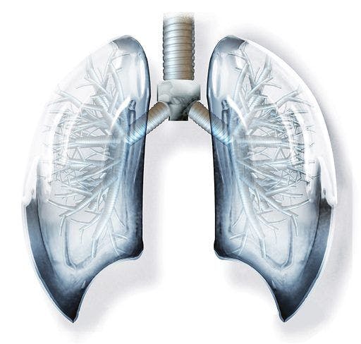 Investigators are assessing avutometinib in combination with sotorasib as a treatment for those with KRAS G12C–mutated non–small cell lung cancer in the phase 1/2 RAMP-203 study.