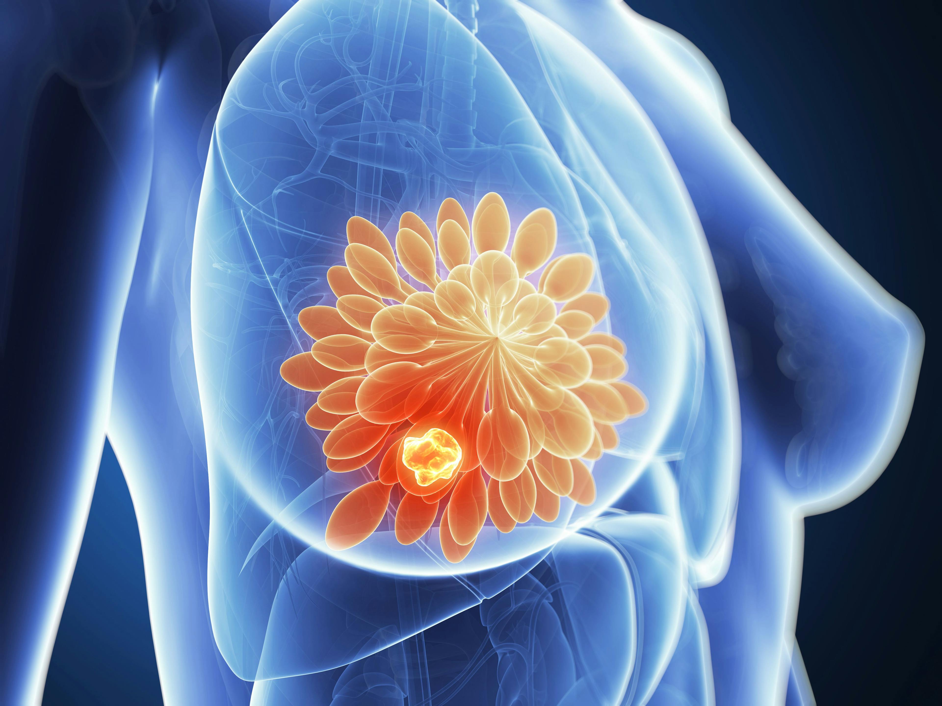 Investigators identified that early changes in standardized uptake value corrected for lean body mass may be able to predict pathologic complete response to pertuzumab AND trastuzumab in patients with HER2-positive breast cancer.