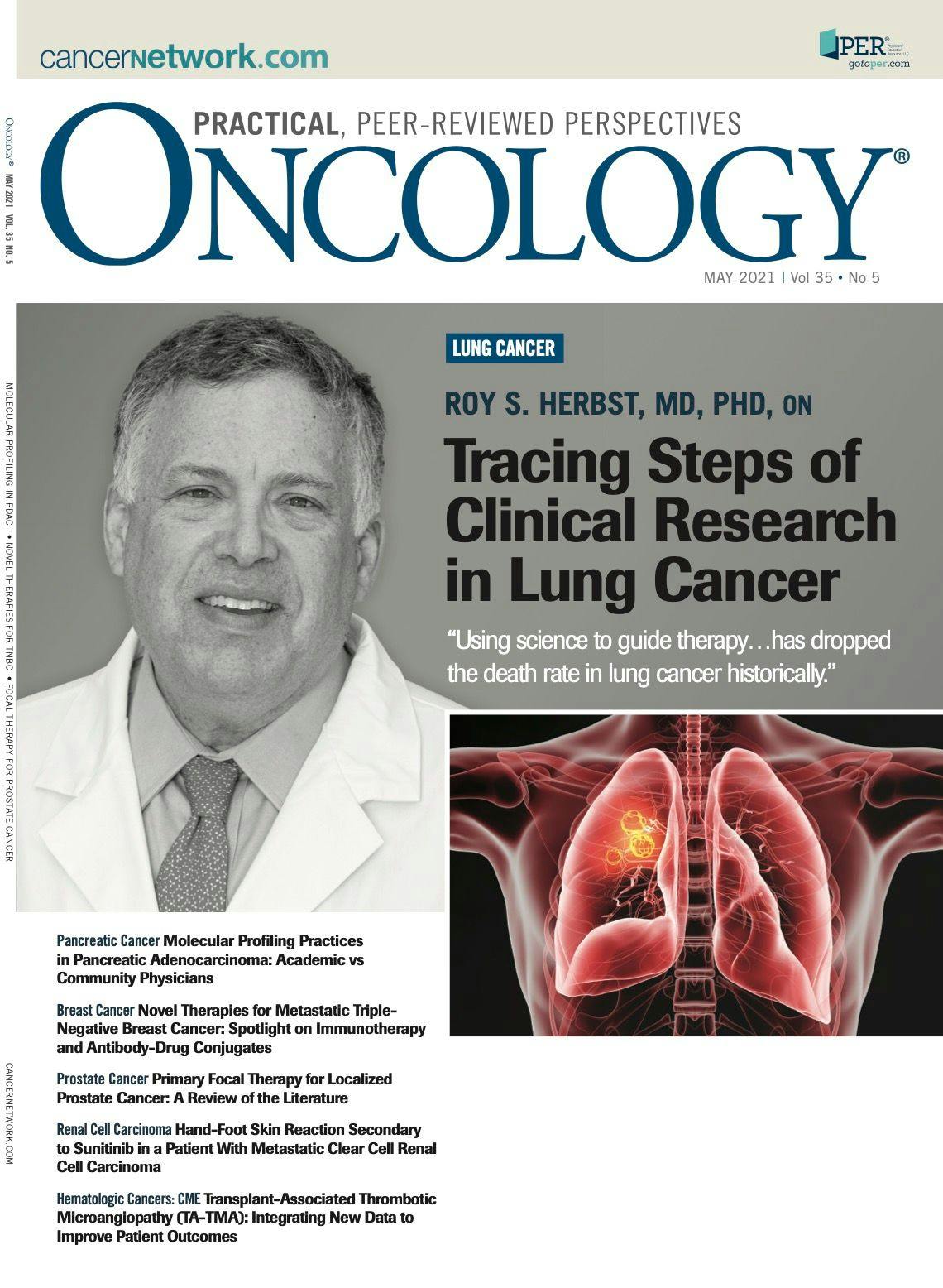 ONCOLOGY Vol 35, Issue 5