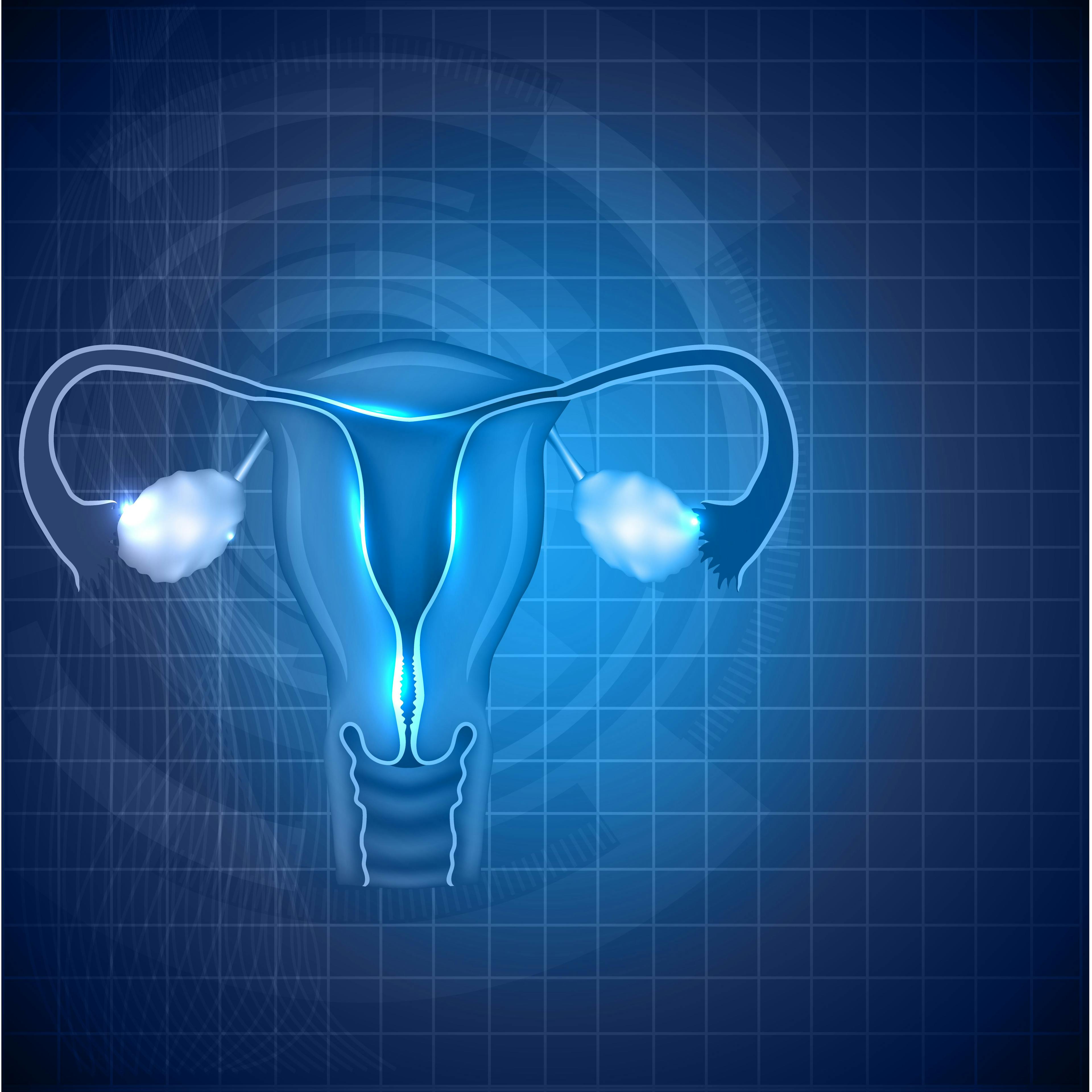 Multidisciplinary Surgical Approach Leads to Decreased Morbidity Rates in Ovarian Cancer