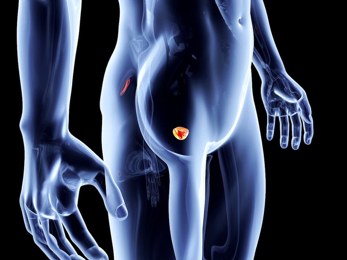 Atezolizumab plus cabozantinib showed significant activity for patients with high-risk metastatic castration-resistant prostate cancer.