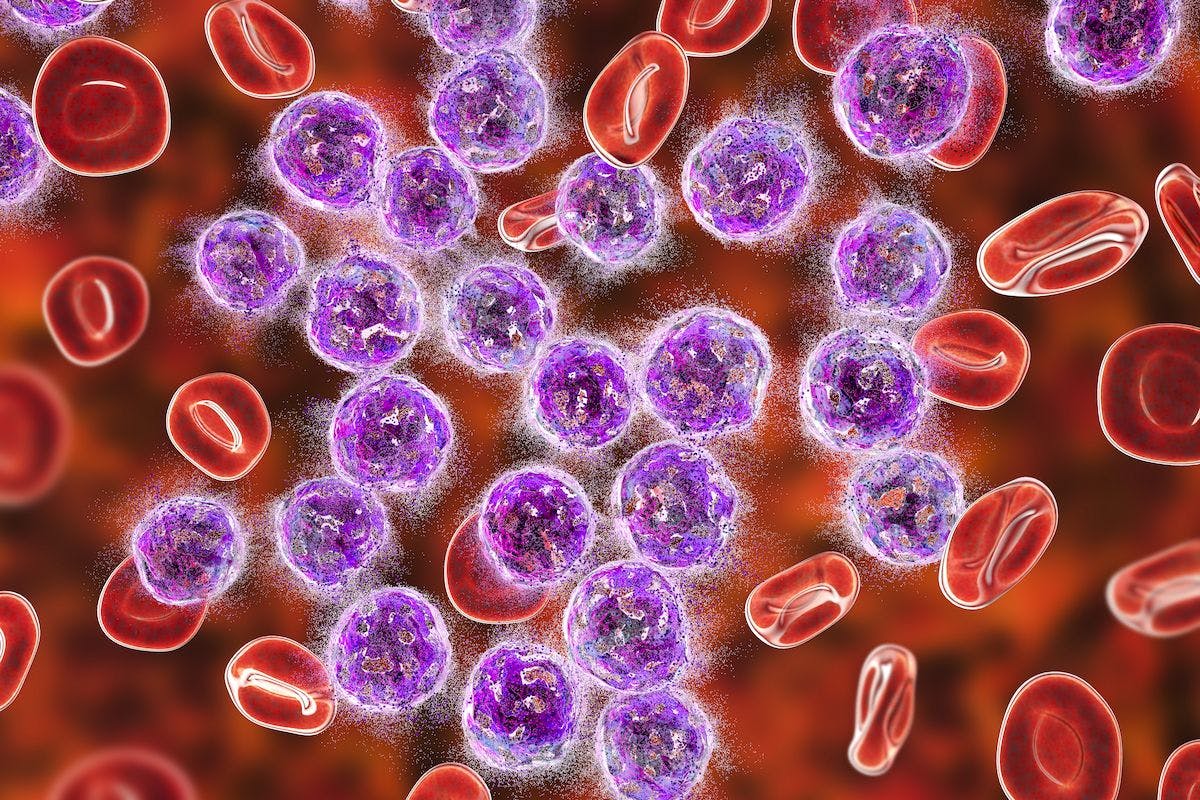 Alternative treatment strategies may be necessary for a high-risk population of patients with acute myeloid leukemia and residual FLT3-ITD.