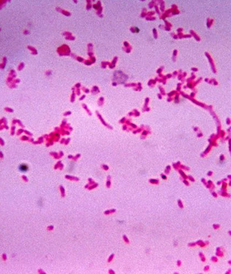 Decreased Diversity of Gut Bacteria Linked With Colorectal Cancer Risk