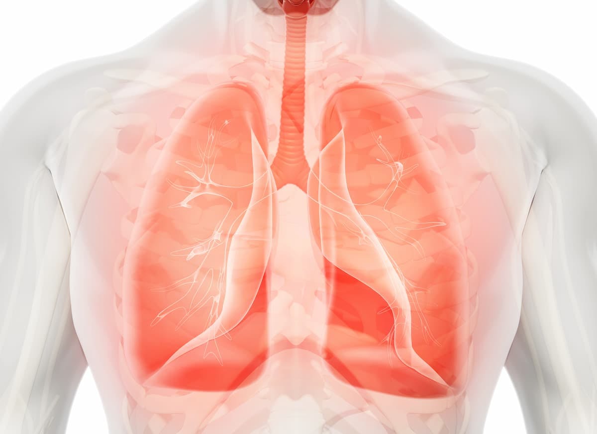 The NEOpredict-Lung trial met its primary end point with nivolumab plus relatlimab for patients with resectable non–small cell lung cancer. 