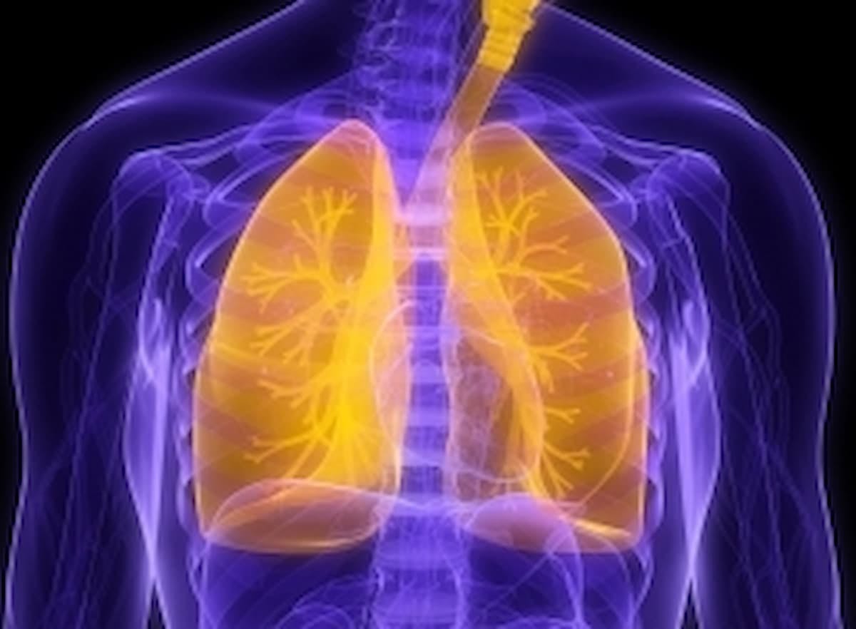 Data from the phase 1/2a AFM24-102 trial support the fast track designation for the AFM24 combination in EGFR wild-type non–small cell lung cancer.