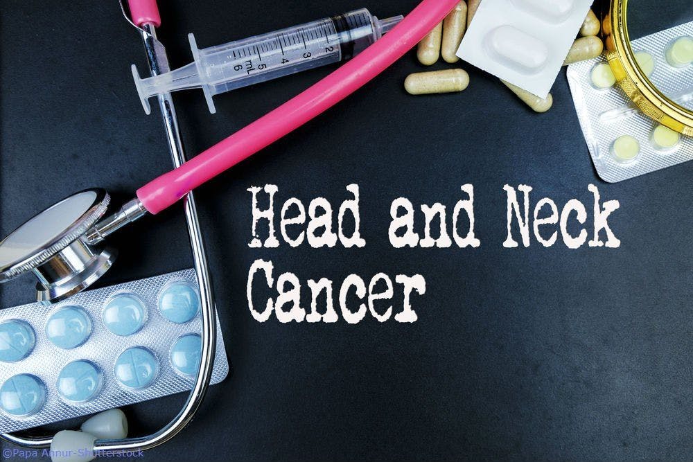 Can New Algorithm Shed Light on Treatment Resistance in Head and Neck Cancer? 