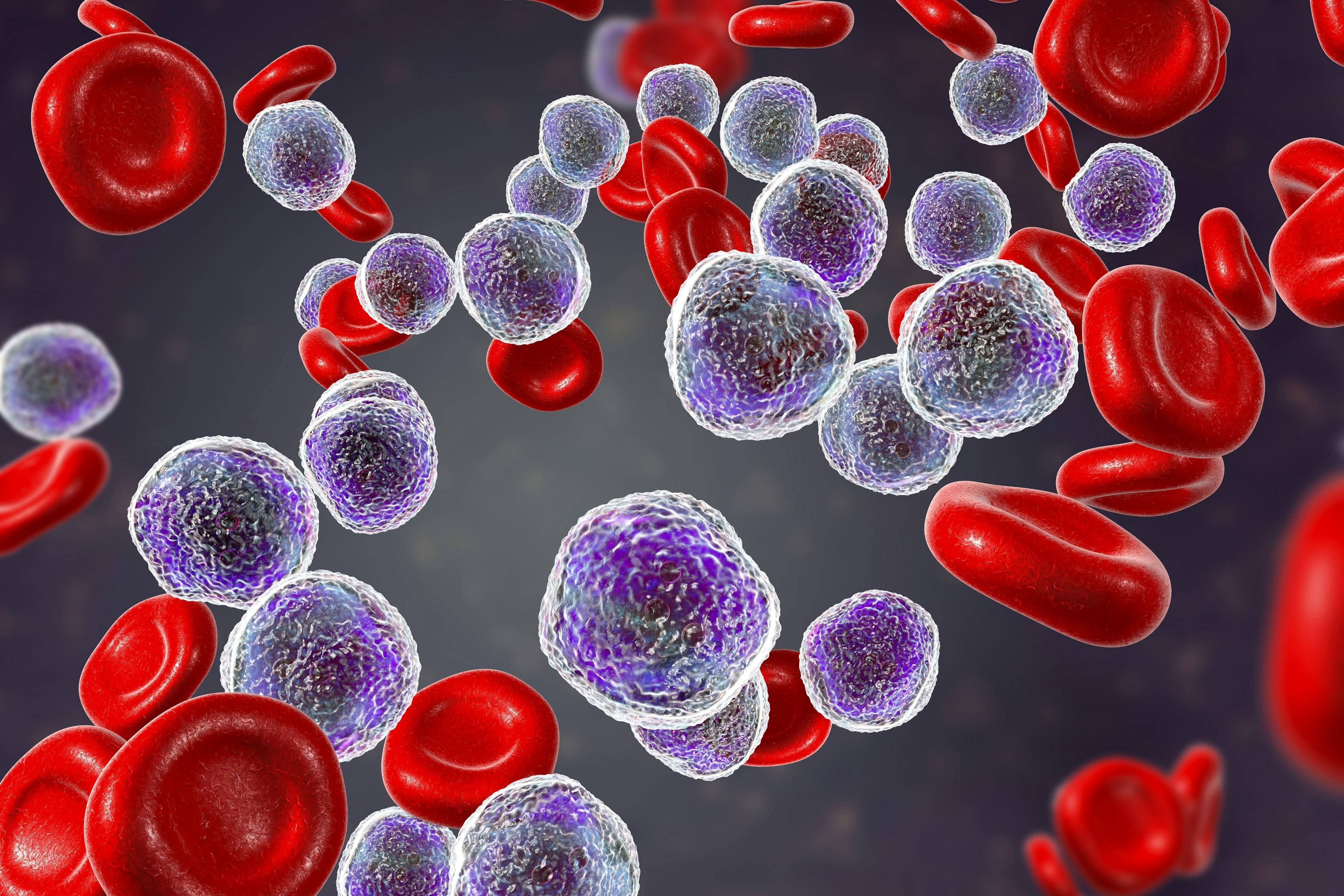 A real-world population of patients with relapsed/refractory B-cell acute lymphoblastic leukemia are reported to have had a high rate of complete remissions following treatment with brexucabtagene autoleucel.