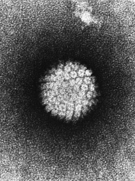 Screening for HPV Outperforms Pap Test for Cervical Cancer