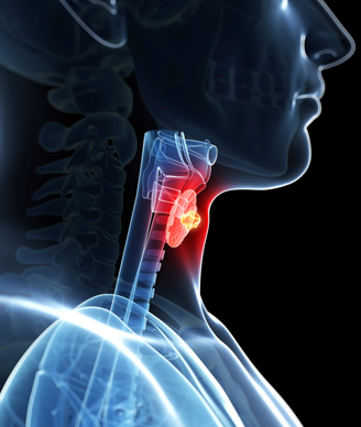 After observing a prevalence of thyroid cancer among transgender female patients through clinical observation, a study was prompted by clinicians in order to determine if this is an issue in a larger population.
