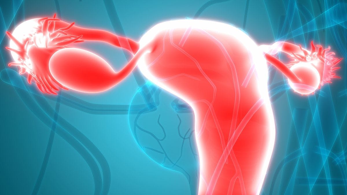  “These data support pembrolizumab plus chemoradiotherapy as a new potential standard of treatment in locally advanced high-risk cervical cancer,” according to lead study author Domenica Lorusso, an associate professor of Obstetrics and Gynecology at the Catholic University of Rome and clinical researcher at Fondazione Policlinico Gemelli IRCCS.