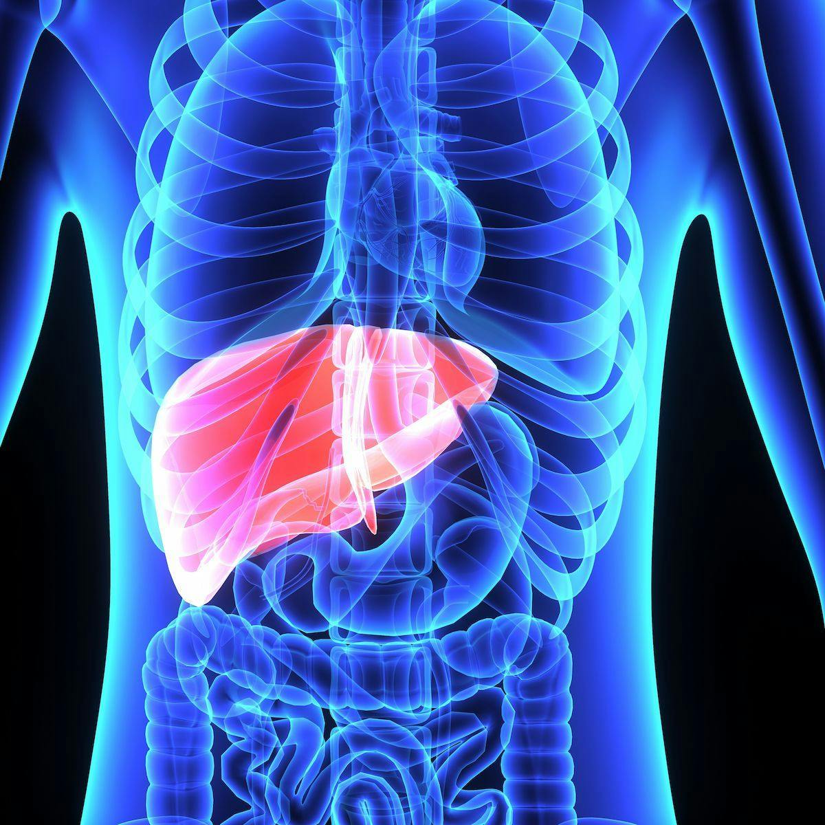 irAEs May be Manageable With STRIDE Regimen in Unresectable Liver Cancer