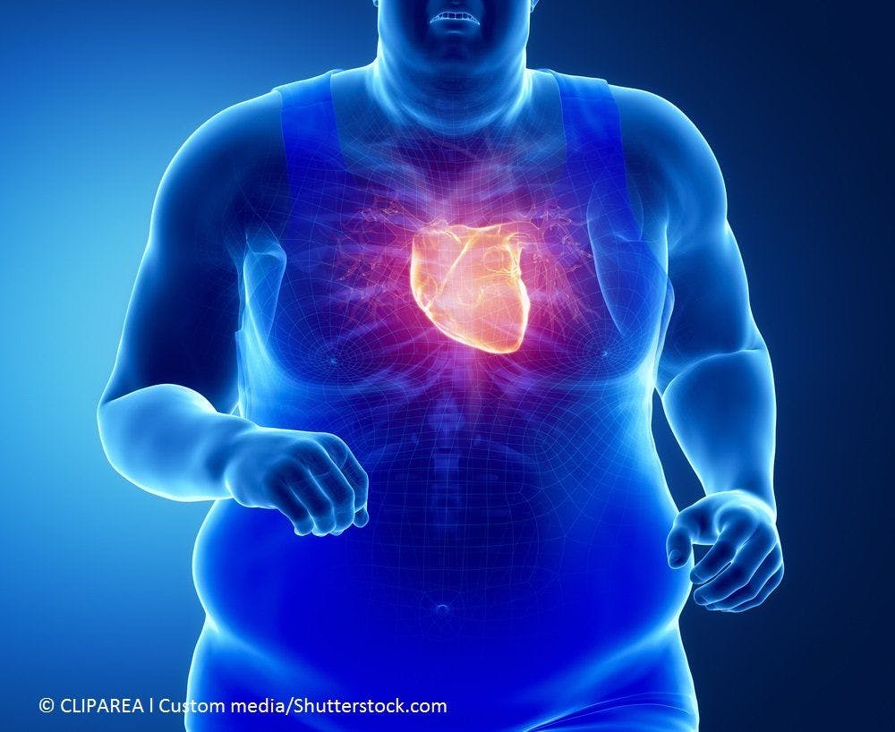 Obesity in Early-Stage Breast Cancer May Increase Risk for Cardiotoxicity