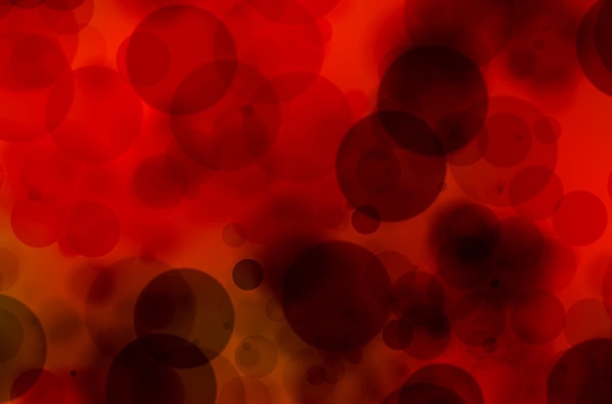 Investigators will present data from the phase 3 LIMBER-304 trial evaluating parsaclisib plus ruxolitinib in myelofibrosis at a future medical meeting.