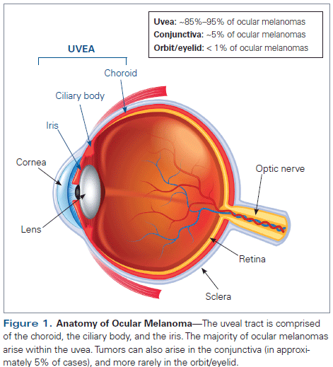 Clinical Management of Uveal and Conjunctival Melanoma