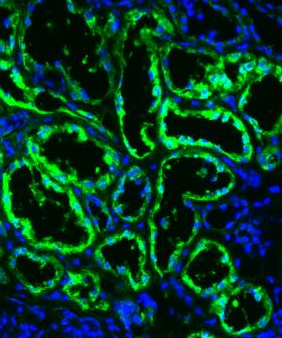 Image of primary human kidney tissue: FBP1 protein (green); cell nuclei (blue)