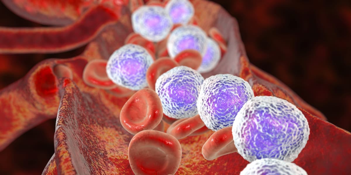 The European Commission approved lisocabtagene maraleucel for the treatment of certain patients with relapsed/refractory large B-cell lymphoma.
