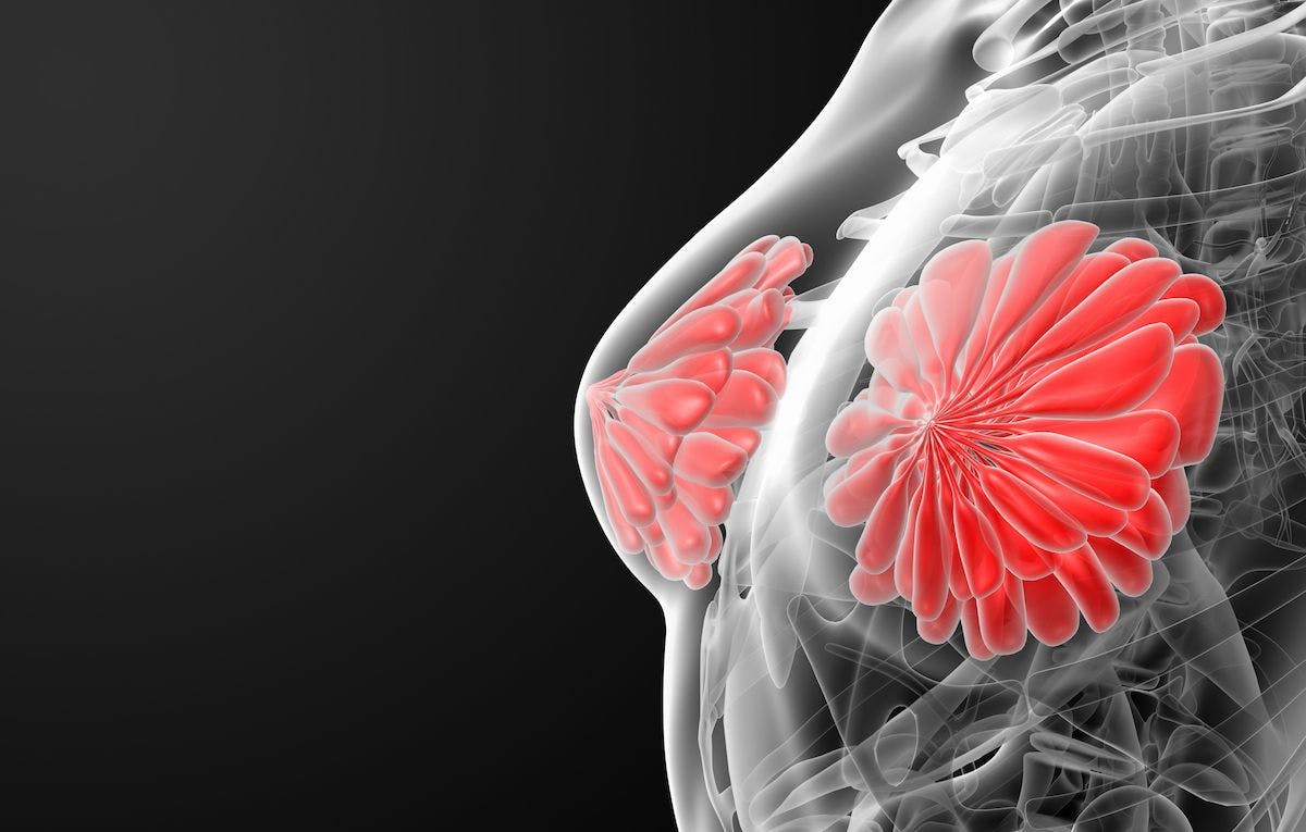 Image-guided vacuum core biopsy "will need to be tested in several larger studies before it becomes a standard treatment option" for breast cancer, according to an expert from University of Texas, MD Anderson Cancer Center