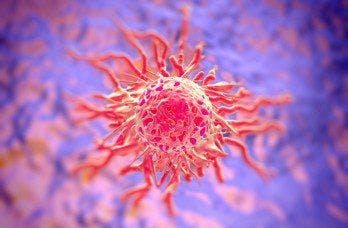 Pembrolizumab Provides Hope for PD-L1–Positive Cervical Cancer Patients