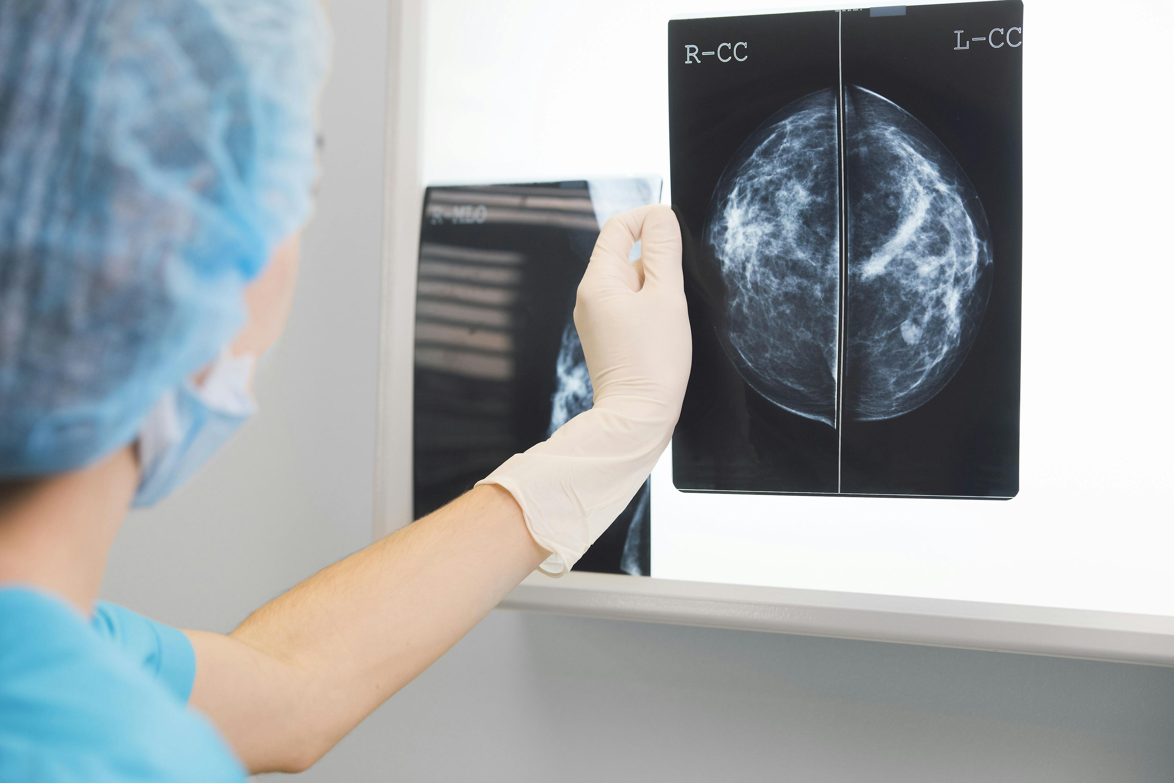 mammogram scans