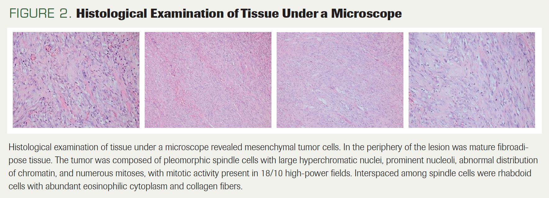FIGURE 2. Histological Examination of Tissue Under a Microscope