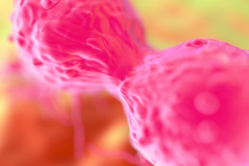 Treatment with zanubrutinib may be a viable option for patients with B-cell malignancies who are intolerant to acalabrutinib, says Mazyar Shadman, MD.