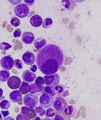Bone Marrow Microenvironment Could Offer Future Target in CML